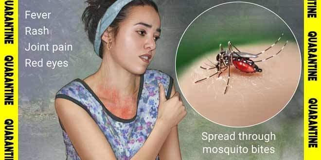 Featured visual summarizing evidence-based guidance related to Zika Virus Symptoms and Early Diagnosis.