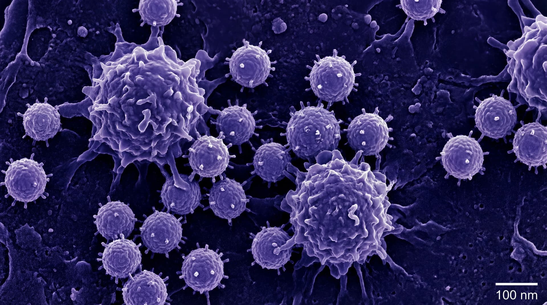 Microscopic visualization of Epstein-Barr virus particles interacting with human immune cells
