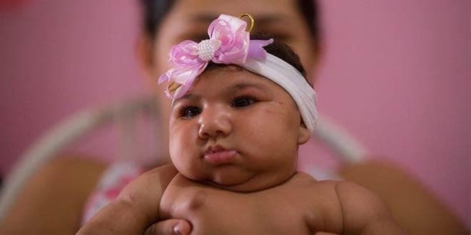 Featured visual summarizing evidence-based guidance related to Zika Outbreak – Summary of a Public Health Emergency.