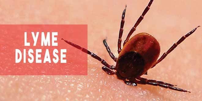 Featured visual summarizing evidence-based guidance related to Lyme Disease Facts and Symptoms | How to Spot the Signs.