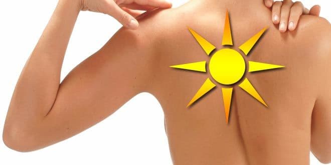 Featured visual summarizing evidence-based guidance related to DIY Natural Remedies Against Sun UV Skin Damage.